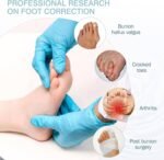 Correct Toes Spacers, Silicone Gel Toe Separators for Pedicure - Image 5