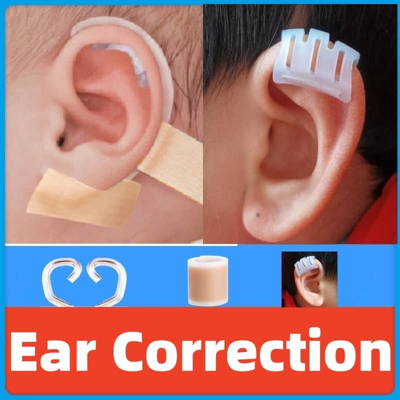 Ear Deformity Corrector Infant, Molding Correction Clip Newborn
