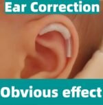 Ape Ear Corrector For Adults, Baby, Newborn and Infant