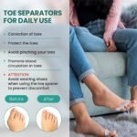 Silicone Toe Spreaders Dividers for Overlapping Toes - Image 4