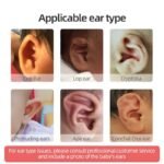Prominent Ear Corrector Clip, Cup Ear Deformity Correction - Image 2
