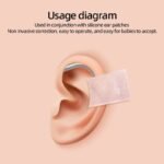 Prominent Ear Corrector Clip, Cup Ear Deformity Correction - Image 3