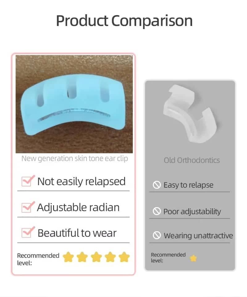 Cryptotia Ear Deformity Treatment Without Surgery, Fixing Repair Cryptotia Non Surgical 4