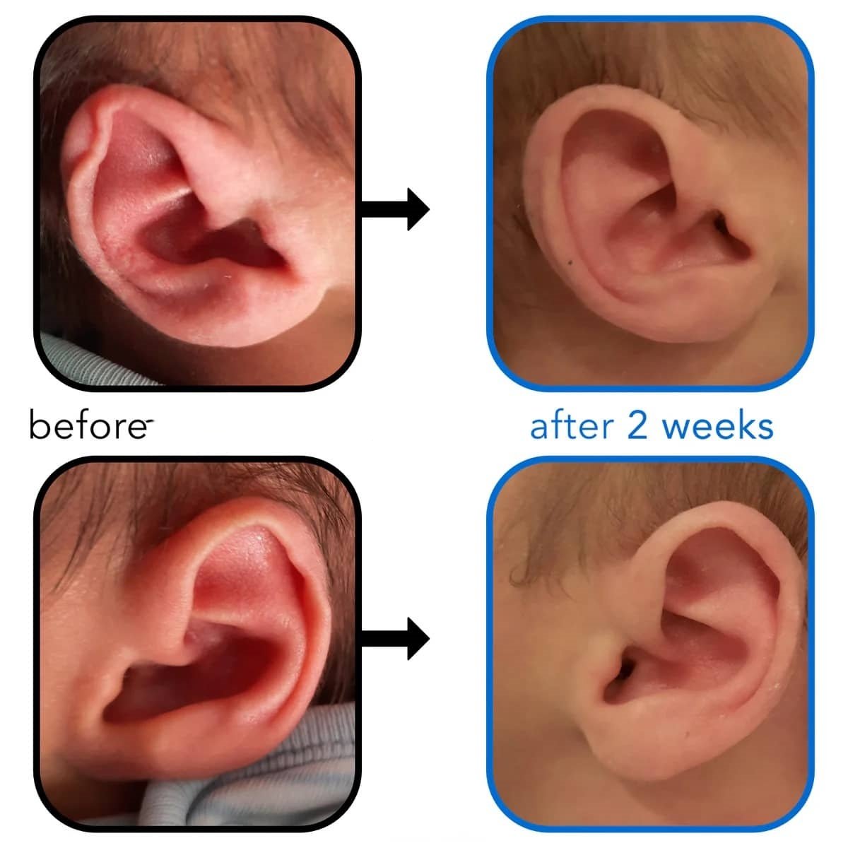 Folded-Over Helical Rim_副本