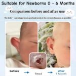 correcting ears that stick out 2