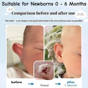 correcting ears that stick out 2