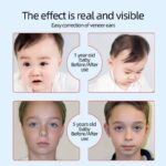 elf ear correction for Veneer Ears 2