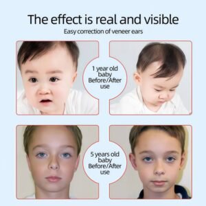 elf ear correction for Veneer Ears 2