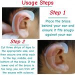 elf ear stickers for Veneer Ears 1