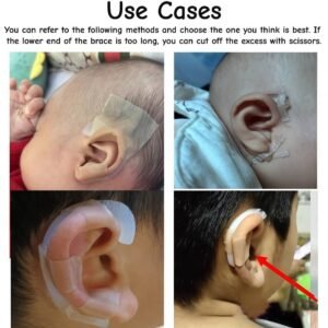 elf ear stickers for Veneer Ears