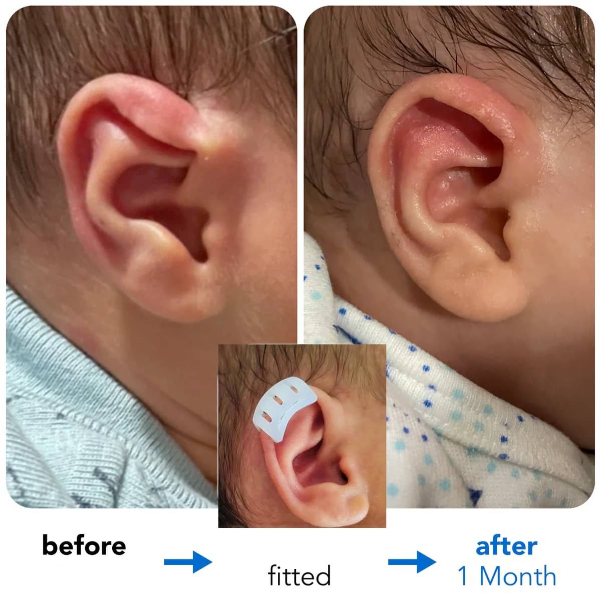 lop ear baby lop ear baby