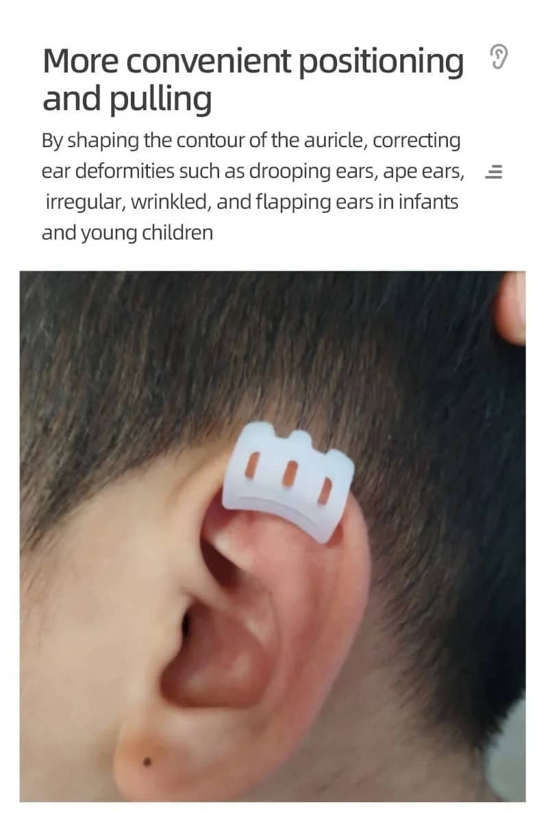 lop ear deformity treatment