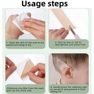 protruding ears without surgery