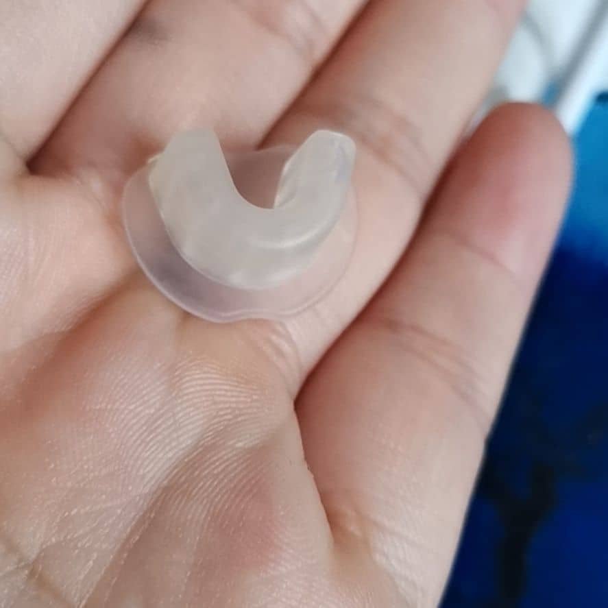 Fixing Conchal Crus Deformity Conchal Crus Ear Correction Without Surgery