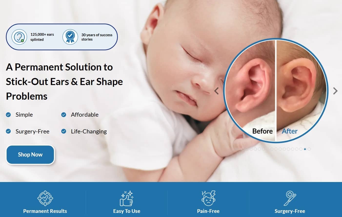 Correcting Stick Out / Cup / Lop Ear Without Surgery